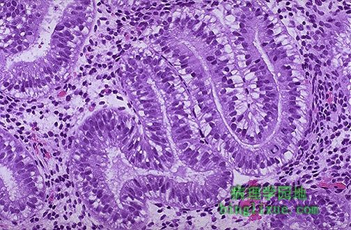 早期分泌期子宫内膜(镜下)