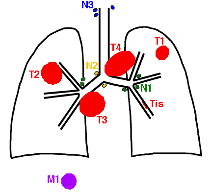 TNMڷ