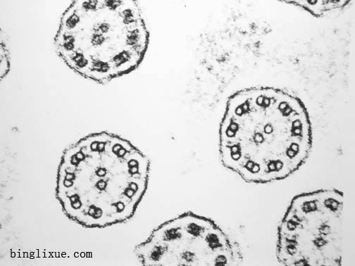 支气管纤毛横切面电镜图