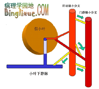 Ѫ쳣Ǻģʽͼ*ɫ쳣Ǻ֧