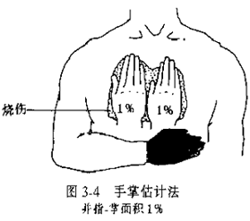 按新九分法计算烧伤面积躯干和会阴占全身面积的 a.25%b.27%c.